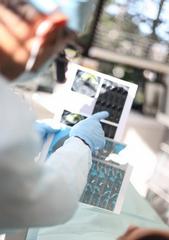Oral implants